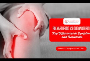 Polyarthritis vs Oligoarthritis