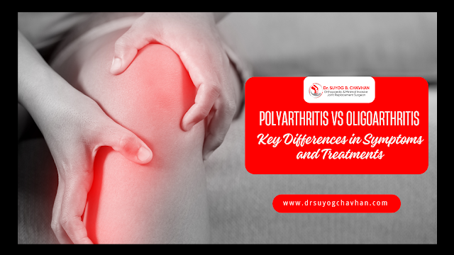 Polyarthritis vs Oligoarthritis