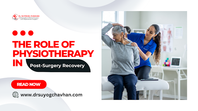 Role of Physiotherapy in Post-Surgery Recovery