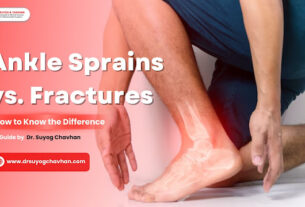 Ankle Sprains vs. Fractures