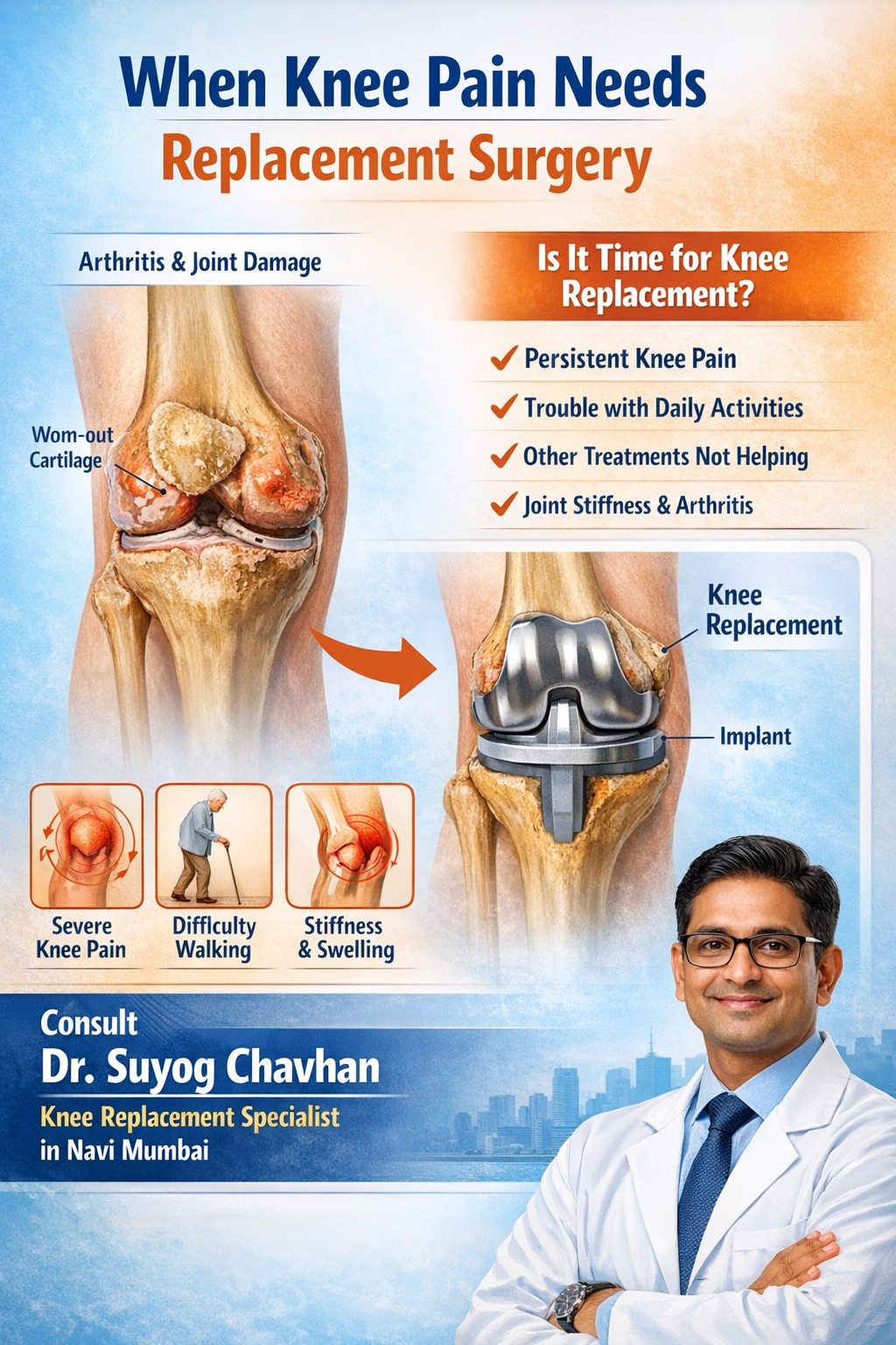 Knee Replacement