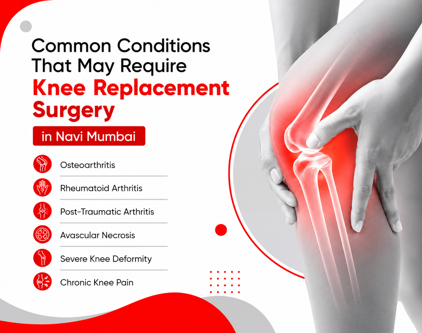 Knee Replacement surgery in navi mumbai