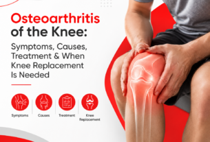 Osteoarthritis of the Knee