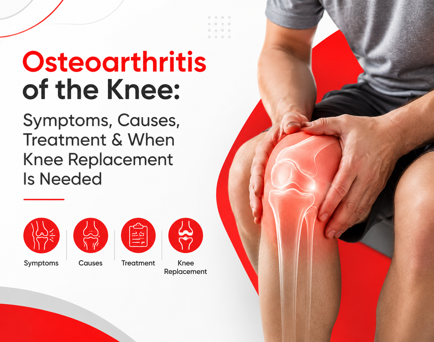 Osteoarthritis of the Knee