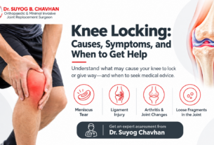 Knee-Locking-Causes-and-Care
