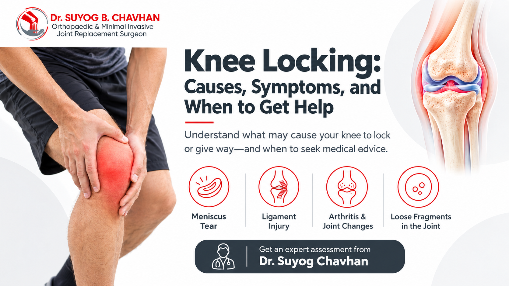 Knee-Locking-Causes-and-Care